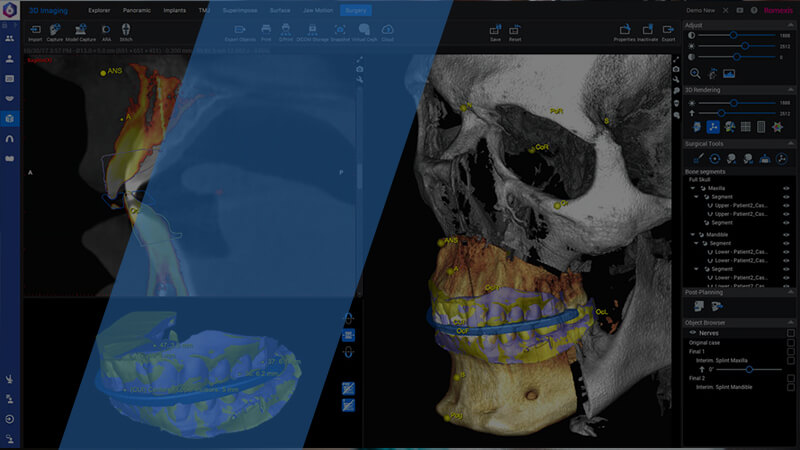 3D printers work for Medical