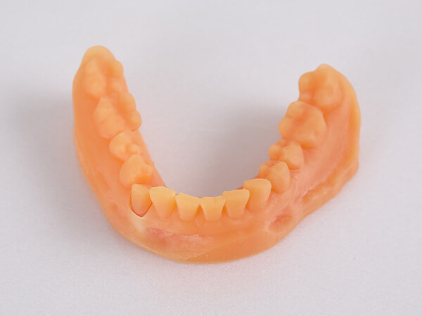 dental 3d printer